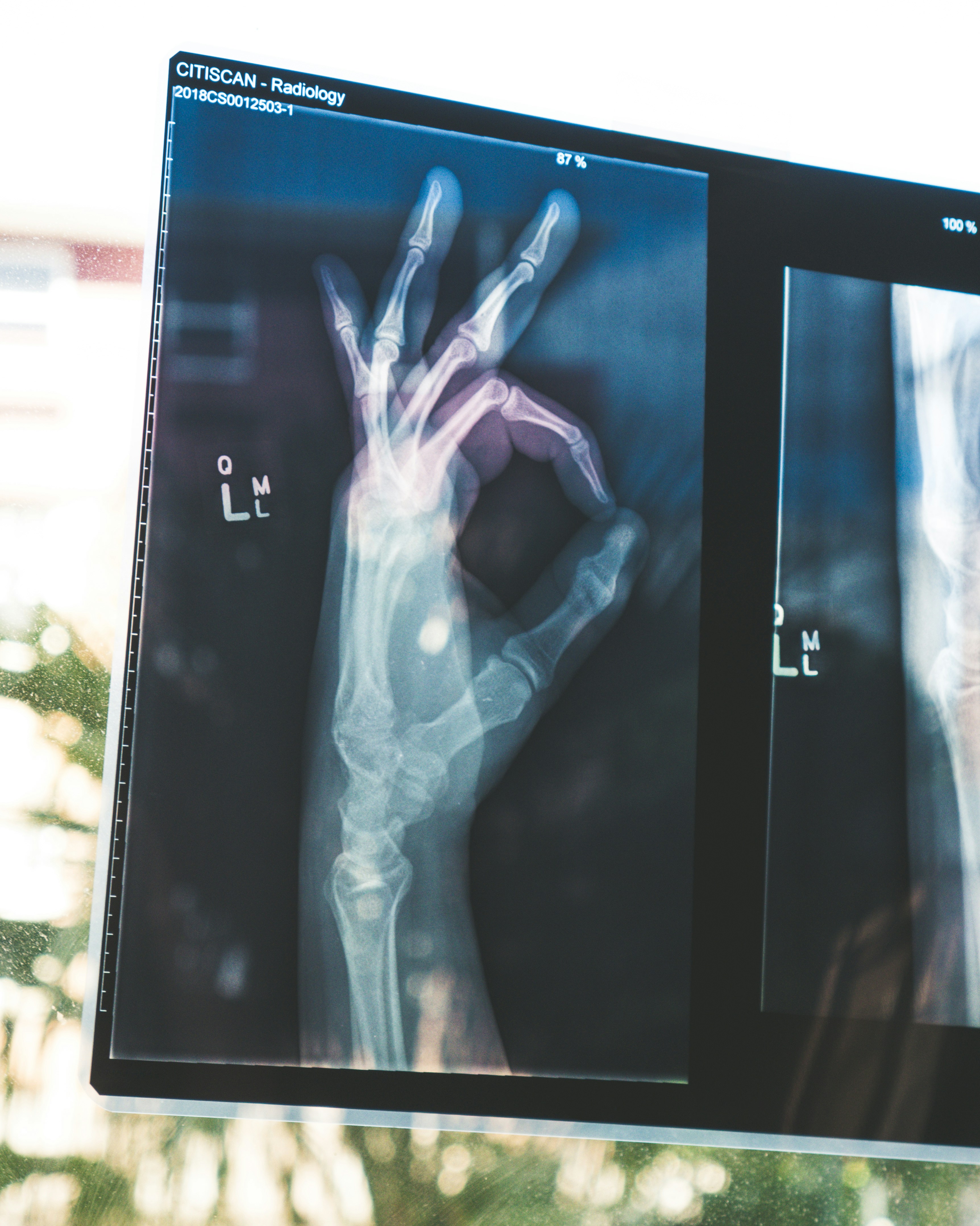 Why Spanish Health Insurance Doesn't Have to Be Complicated